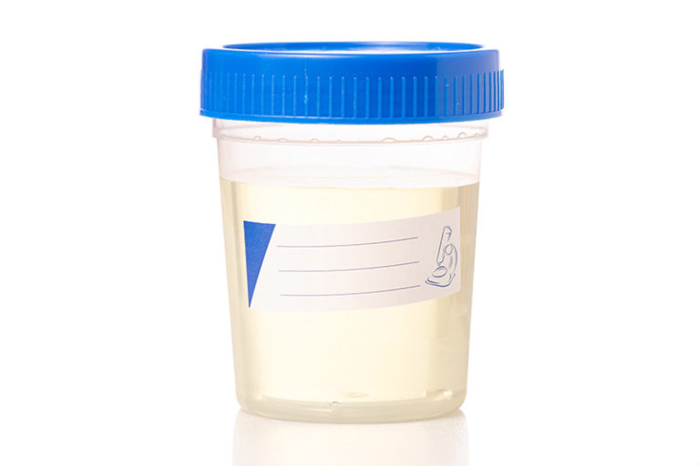 What the Color of Your Urine Reveals About Your Health Page 9 of 9