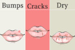 8 Things Your Lips are Trying to Tell You About Your Health