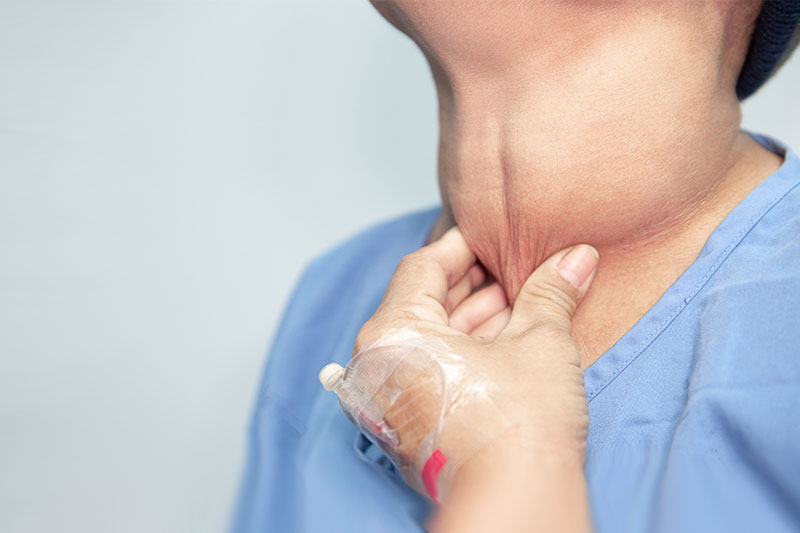 Enlargement Of The Neck thyroid