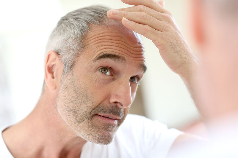 Hair Loss Or Thinning