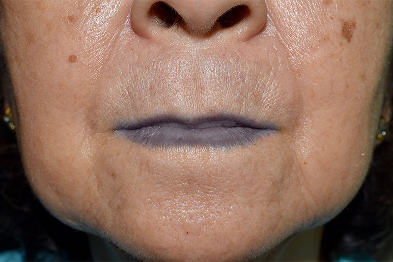 8 Things Your Lips are Trying to Tell You About Your Health 