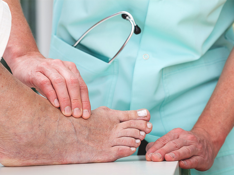 10 Subtle Signs of Dangerous Health Problems Your Feet Can Reveal