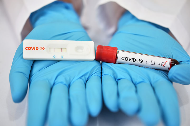 There is Only One Way to Know if You've Already Had Coronavirus