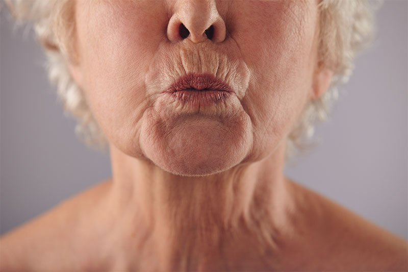 Developing Wrinkles on the Upper Lip Area