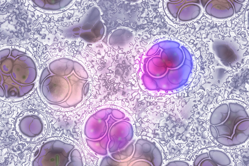 Types and Classifications of Leukemia