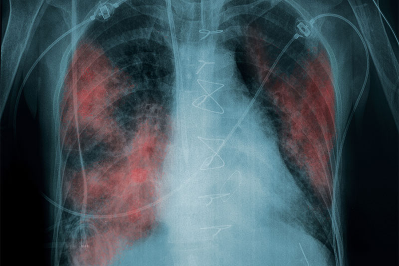 Damage to our lungs