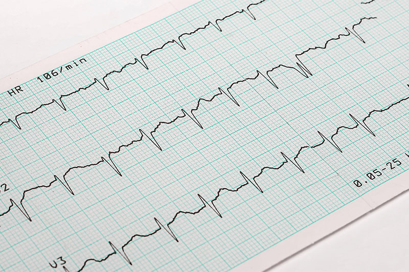 Heart Rate Changes