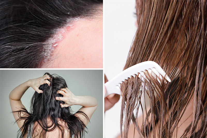 7 Reasons Why You Should NEVER Sleep With Wet Hair Page 2 of 7