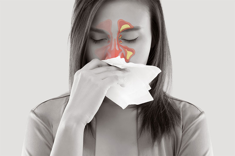 Sinusitis That Is Chronic