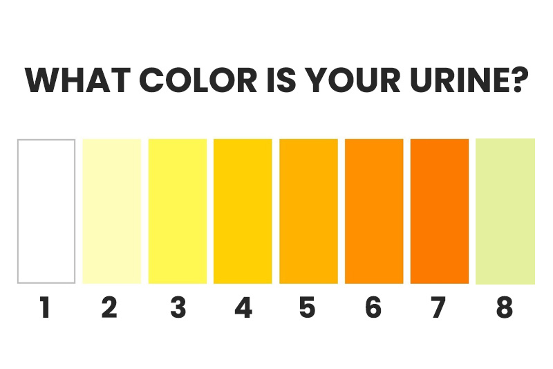 What the Color of Your Urine Reveals About Your Health 